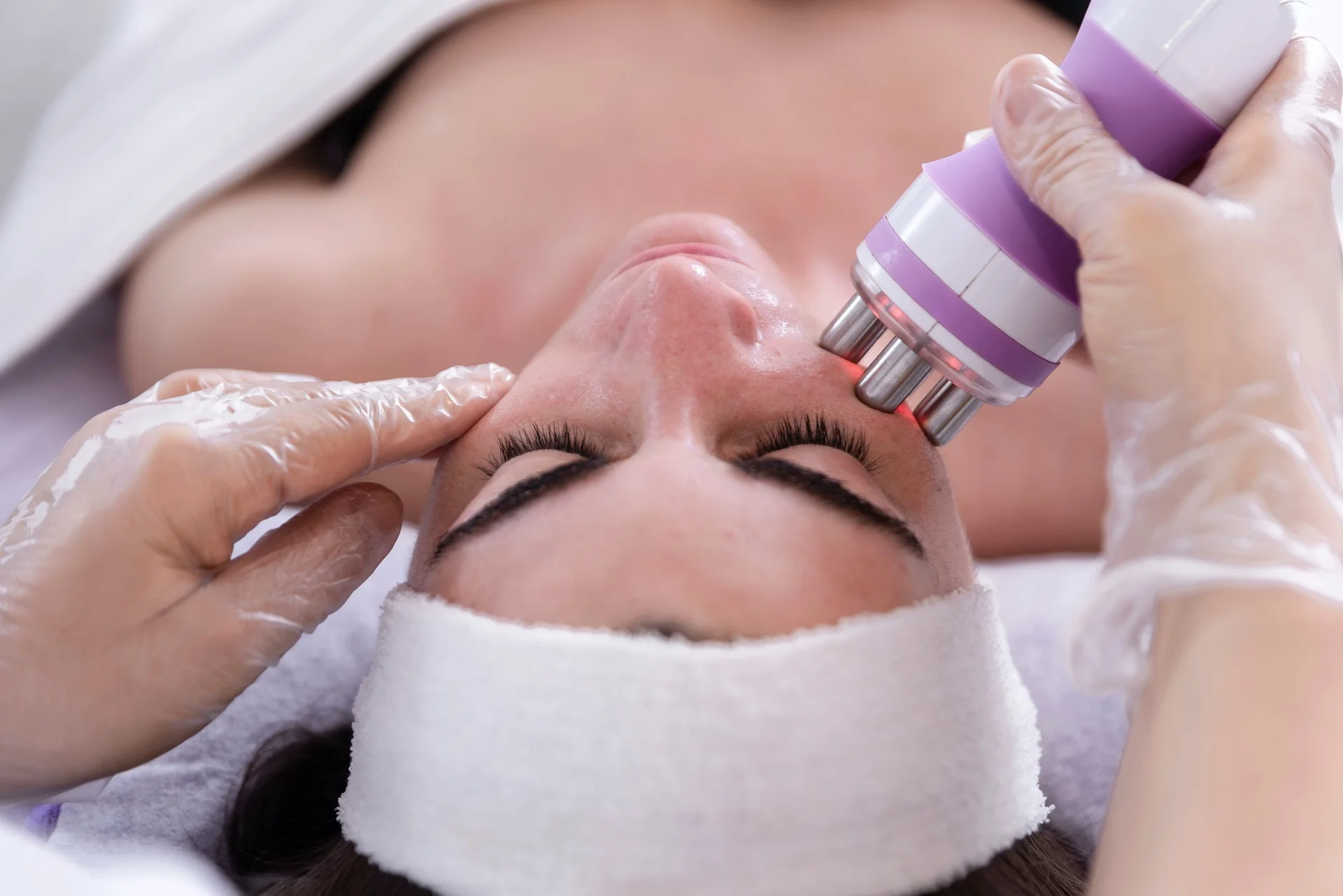 Radio-Frequency Treatments service in Glendale, CA
