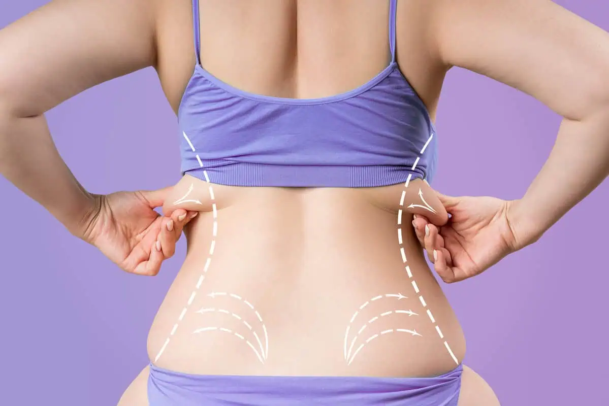 Fat Reduction by contour lounge in Glendale, CA (1)